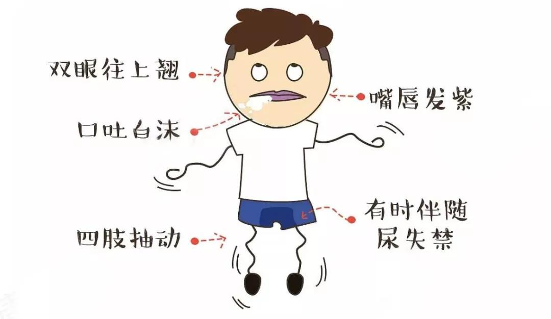 我叫&ldquo;癫痫&rdquo;，俗称&ldquo;羊癫疯&rdquo;，你了解我多少？