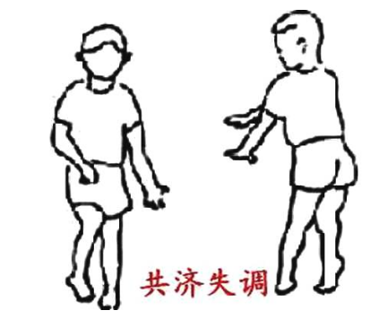 生命不能承受之重&mdash;共济失调